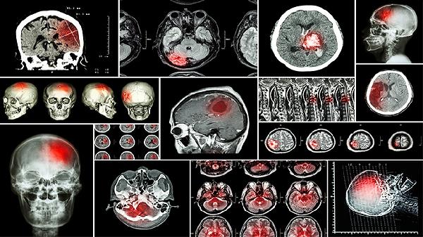 女人春季摄生要注意什么？应把握这4大摄生准则！